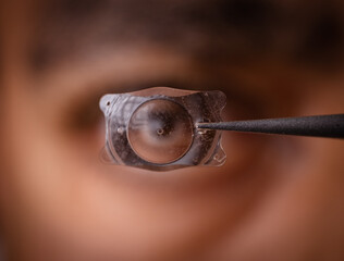 photo of Implantable Collamer Lens ICL for treating refractive errors, infront of a lights