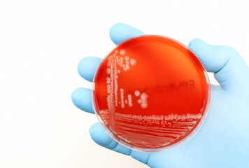 Escherichia coli (E. coli) bacteria grown in a Petri dish in the Microbiology laboratory