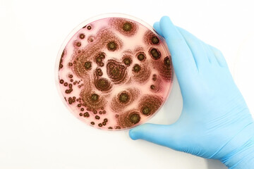 A Petri dish with fungal colonies in the Microbiology laboratory. 