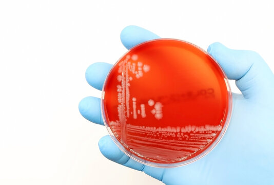 Escherichia coli (E. coli) bacteria grown in a Petri dish in the Microbiology laboratory