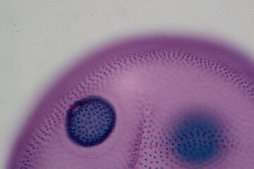 photo of green algae under the microscope