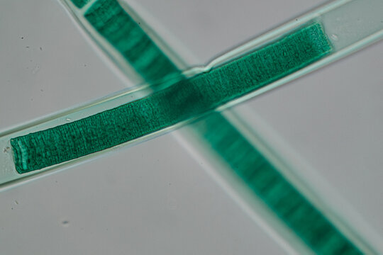 photo of green algae under the microscope