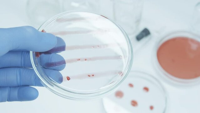 Bacteria and microbial cultures growth on a petri dish in microbiology lab. Candida auris. Biomarker. Bio-reagent. Fungus and mold. Cyanobacteria Colony. Culture medium plate. 