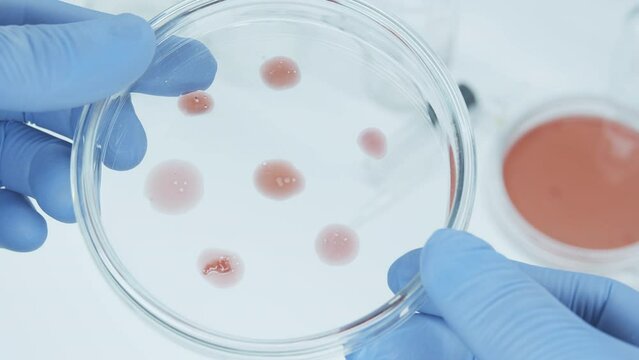 Bacteria culture on a petri dish in microbiology lab. Candida auris. Microbial cultures growth on selective media plate. Biomarker. assistant holds the petri with gloves