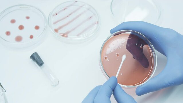 Bacteria culture growth on a petri dish in microbiology lab. Candida auris. Microbial cultures growth on selective media plate. Biomarker. Bio-reagent. Fungus and mold.  Biomass. Colony-forming unit