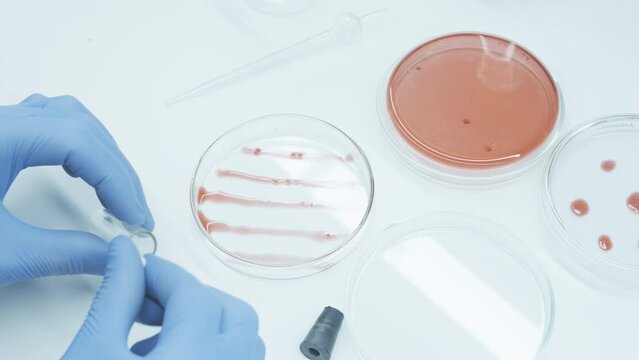 Bacteria culture growth on a petri dish in microbiology lab. Candida auris. Microbial cultures growth on selective media plate. Biomarker. Bio-reagent. Fungus and mold.  Biomass. Colony-forming unit