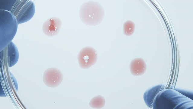 Bacteria culture growth on a petri dish in microbiology lab. Candida auris. Microbial cultures growth on selective media plate in microbiology laboratory. Biomarker. Bio-reagent. Fungus and mold.