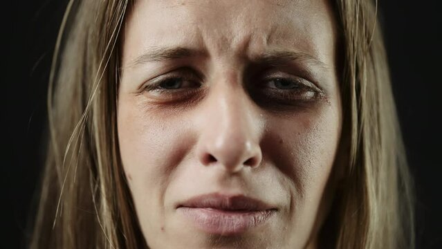 A sad beaten up woman with tear in eye and bruises is crying or shouting. Female depression because of domestic violence. Need help and support. Concept violence or cruelty and hopelessness or despair