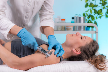Dermatology Doctor Measures Mole with Digital Caliper Measuring Tool