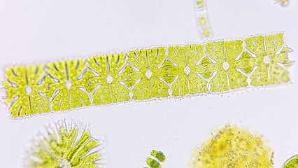 Filament-forming phytoplankton, Micrasterias foliacea. Live cell. Selective focus