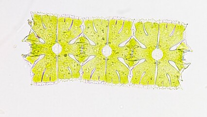Filament-forming phytoplankton, Micrasterias foliacea. Live cell. Selective focus