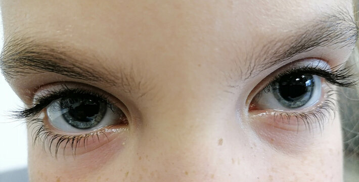 children's eye with dilated pupils. High quality photo