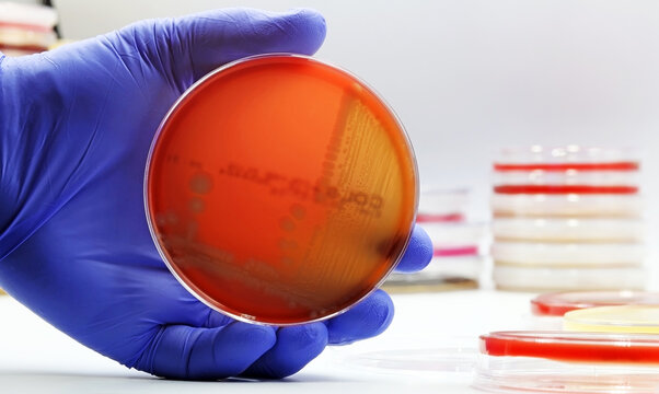 Escherichia coli (E. coli) bacteria growing in a Petri dish with Agar-blood culture medium, in the Microbiology laboratory
