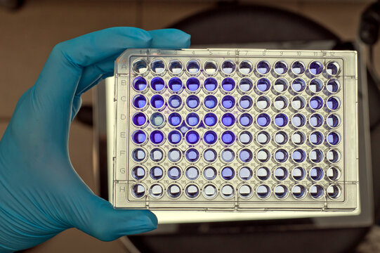 Immunoassay Bilder Durchsuchen 961 Archivfotos, und