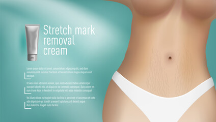 Stretch Mark Removal Cream. Skin Care Ad Template - obrazy, fototapety, plakaty