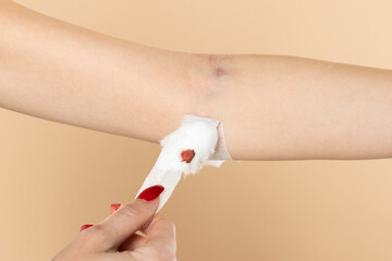 woman patient show cotton wool stop bleeding, after blood drawing testing for annually physical...