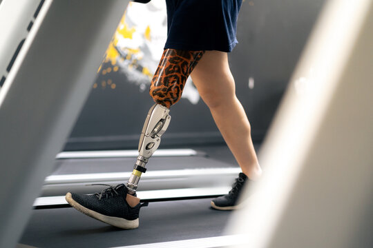 Woman with prosthetic leg using walking on treadmill while working out in gym.