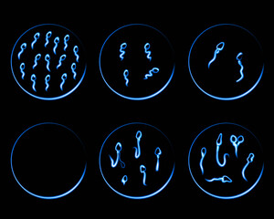 Vector isolated illustration of sperm pathologies. Spermogram. Sperm defects. Defects of the sperm head.  Sperm motility.