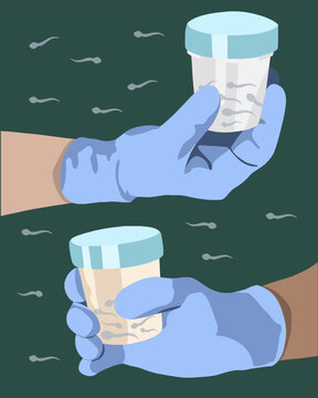 Sperm donation. Sperm analysis. Spermogram. Vector isolated illustration of jar with sperm held by hand. Sperm defects.