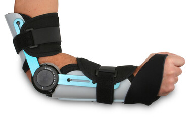 Broken arm in a cast