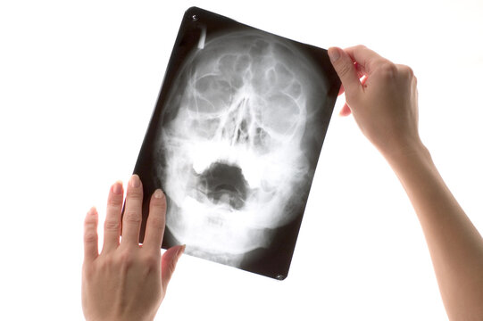 Inspecting x-ray shot