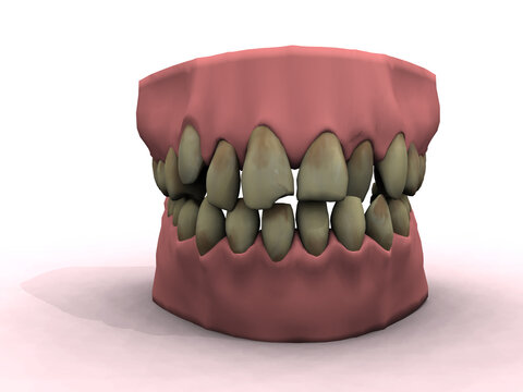 teeth show bad decay and ugly coloring