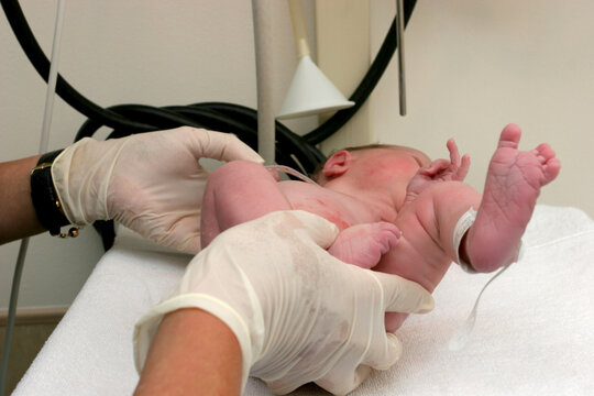 A new born baby being checked after delivery