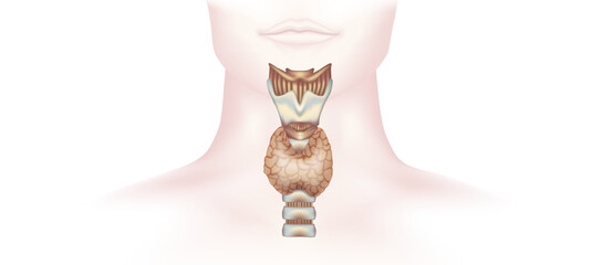 hypothyroidism vs hyperthyroidism. healthy and unhealthy thyroid test. Thyroid tumour and inflammation treatment. Parathyroid glands. neck pain and sore. Throat cancer and esophagus. Goitre problem. 