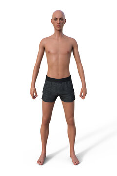 A 3D illustration of a male body with ectomorph body type