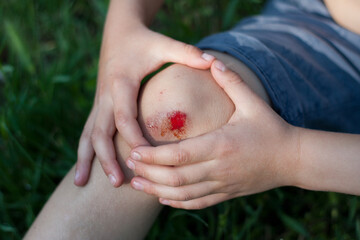 Closeup of fresh bleeding wound on child knee due to fall. Childhood trauma, pain, carelessness, accident. Summer, outdoor
