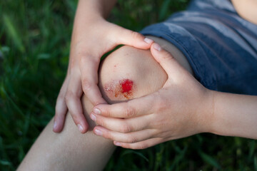 Closeup of fresh bleeding wound on child knee due to fall. Childhood trauma, pain, carelessness,...