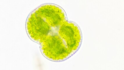 Freshwater phytoplankton, Cosmarium connatum, Live cell. Selective focus