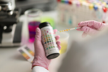 Doctor holds reagent strip for urinalysis closeup. Control analysis of urine in laboratory concept