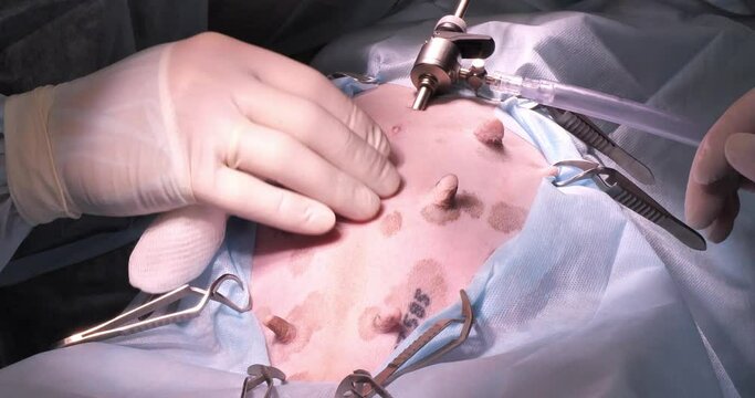 In surgery, a veterinary surgery team performs laparoscopic sterilization of a dog. A team of surgeons operate endoscopically on an anesthetized dog on an operating table.