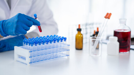 Doctor hand taking a blood sample tube from a rack with machines of analysis in the lab background,...