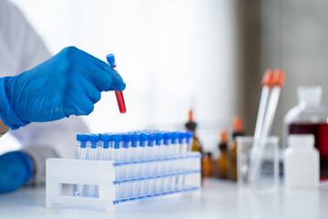 Doctor hand taking a blood sample tube from a rack with machines of analysis in the lab background, Technician holding blood tube test in the research laboratory.