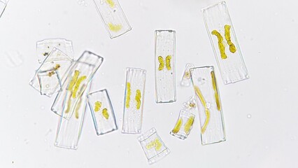 Eunotia sp, a freshwater phytoplankton belonging to diatom group