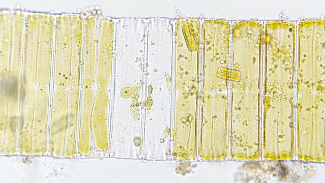 Eunotia sp, a freshwater phytoplankton belonging to diatom group