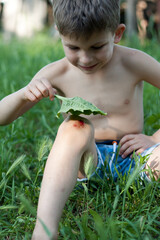 Portrait of preschool boy with fresh bleeding wound on knee. child fell, scratched skin on knee,...