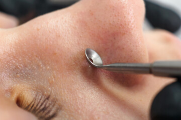 Mechanical facial cleansing with metal device at the beautician clinic. Cosmetology Professional...