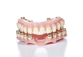Dental implant. Dentistry concept. Human teeth or dentures.