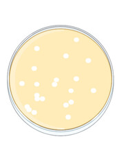 Phage display in petri - Plaque assay