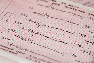 heart rhythm ekg note on paper Doctors use it to analyze heart disease treatments.