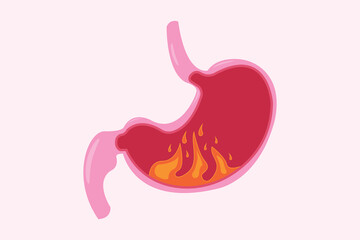 Illustration from acid reflux or heartburn, Cartoon vector, Concept with internal health. fire in stomach. eps 10