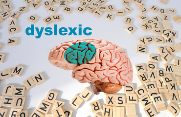 Neural Signature in human brain for Dyslexia, Disruption of Posterior Reading System on blue...