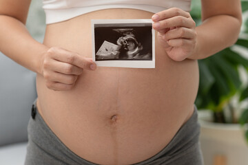Close up Happy Pregnant Woman holding ultrasound image stroking big belly with love isolated on couch,Pregnancy of young woman enjoy with future life,Motherhood and Pregnant Concept