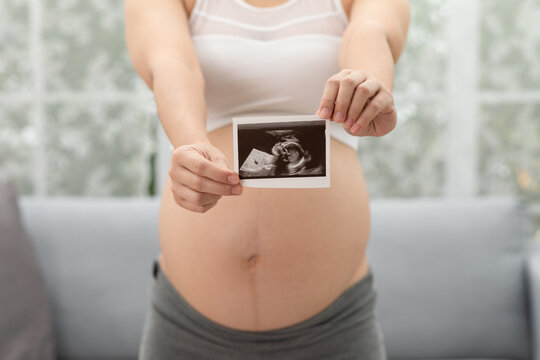 Close up Happy Pregnant Woman holding ultrasound image stroking big belly with love isolated on couch,Pregnancy of young woman enjoy with future life,Motherhood and Pregnant Concept
