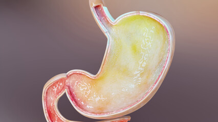 human stomach with gases. Bloating and flatulence, flatulence and gastrointestinal tract, Bloating digestion system, stomach ache or cramps, gastritis, stomachache, indigestion, vomiting, 3d render - obrazy, fototapety, plakaty
