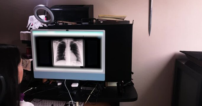 Lock shot woman caucasian pulmonologist revises study X-ray on computer pulmonary diagnostic of human respiratory system