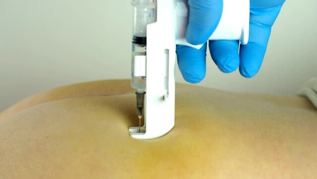 Intramuscular injection, injection into the back muscle, with a special syringe gun.